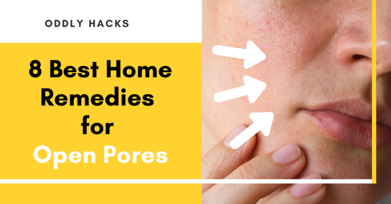 8 Best Home Remedies for Open Pores