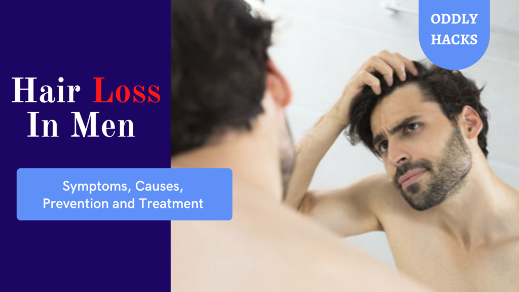 Hair Loss In Men: Symptoms, Causes, Prevention and Treatment